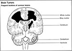 neurosurgery-hospital-india