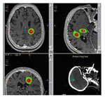 neurosurgery-hospital-india