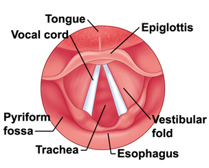 Laryngectomy, Laryngeal Surgery, Larynx, Laryngectomy Surgery India, Total Laryngectomy