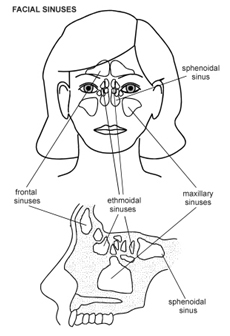 Maxillary Sinus Antral Washout Surgery, Maxillary Antral, Sinus Washout, Maxillary Sinusitis