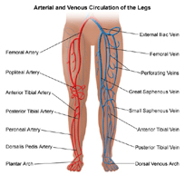 Femoro-Popliteal Bypass Surgery offers info on Femoro-Popliteal Bypass India, Fem-Pop Bypass India