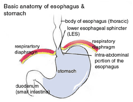 Reflux Disease India, GERD India, Symptoms Of Reflux Surgery India, Reflux India, Gastro esophageal Reflux Disease India