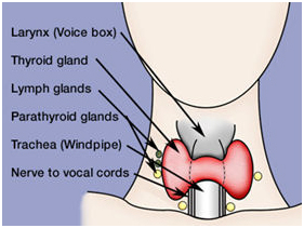 Thyroidectomy Cancer India, Thyroidectomy Surgery India, Thyroid Cancer India