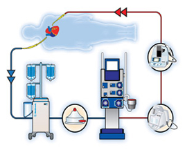 Off Pump Beating Surgery, Heart Surgery, India Cabg Surgery, Opcab, Off-Pump Heart Bypass Surgery