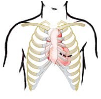 On-Pump Cardiothoracic Surgery, Coronary Artery Bypass Surgery