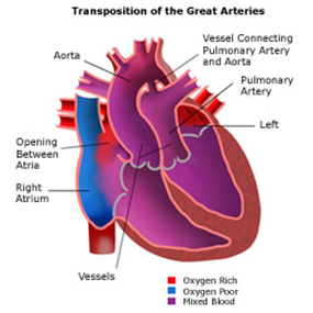 Pediatric Heart Surgery