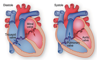 Valve Repair, Valve Repair Surgery India, Low Cost Surgery, Affordable Surgery