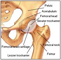 Hip Arthroplasty India, Review Of Hip Arthroplasty, Definition Of Hip Arthroplasty