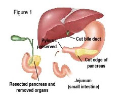 Endoscopy India, Gastroenterology India, Gastroenterology Hospital Kolkata, Gastroenterology Hospital India