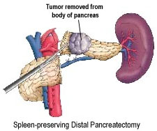 India Liver Disease, Gastroenterology Hospital Kolkata, Oesophago Gastro Duodenoscopy in Kolkata