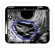 Signs Of Ovulation On Clomid