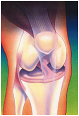 Arthroscopy Surgery, India Arthroscopic Surgery, Arthroscopic Procedure