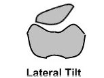 Arthroscopic Lateral Release Surgery, Arthroscopic Lateral Retinacular Release