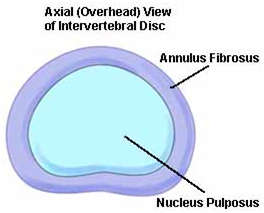 Lumbar Radiculopathy, India Radiculopathy Cervical