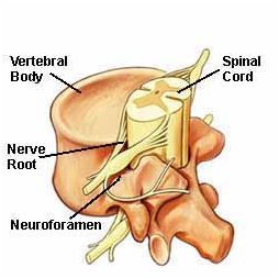 India Radiculopathy Cervical, Radiculopathy Symptoms, Leg Pain, Low Back , Radicular Pain