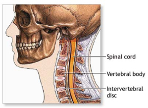 Neck Pain, Neck Surgery India, India Cure For Neck Pain