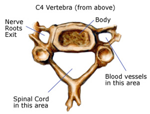 Neck Surgery India, India Cure For Neck Pain, Cure For Back Pain, Neck & Shoulder Pain Center