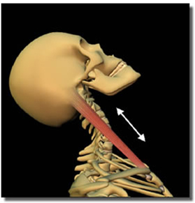 Whiplash Surgery, Whiplash Surgery India, Whiplash, Surgery, Recovery, Neck Pain, Injury