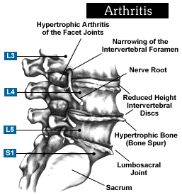 , Spine, India General Spinal Anatomy, Cervical