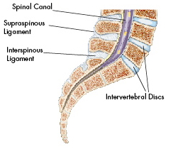 X Stop, Spine Surgery Procedure, X Stop Procedure