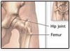 Heart Surgery Hospital, Wockhardt, Wockhardt Hospital, Mumbai Hospitals