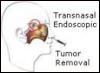 Heart Surgery Hospital, Wockhardt Hospital, Mumbai Hospitals, Delhi Hospitals