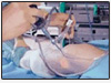 Wockhardt Heart Surgery Hospital Mumbai, Heart Surgery Hospital, Mumbai Hospitals