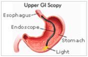 Minimal Access Invasive Surgery Wockhardt Hospital in Mumbai, Invasive Surgery