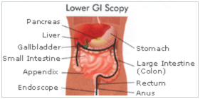 Minimal Access Invasive Surgery Wockhardt Hospital Mumbai, Minimal Access Invasive Surgery Wockhardt Hospital in Mumbai