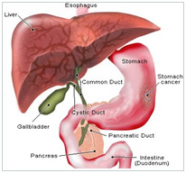 Minimal Access Invasive Surgery Wockhardt Hospital Mumbai, Laparoscopic-Cholecystectomy