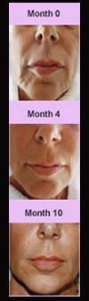 Face Sculpting, Sculpt A Face, Sculpt, Face Exercises, Facial Exercises, Face Sculpting Foundation