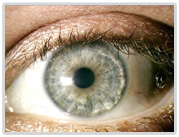 Penetrating Keratoplasty Surgery, Penetrating Keratoplasty India