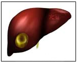 Amoebic Abscess Treatment  India offers info on Amoebic Abscess Symptoms India, Amoebic Abscess Treatment  India Hospital Tour India