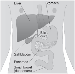 Bladder Cancer Treatment   India, Cancer Treatment In   India, Cancer Cure & Prevention India, Bladder Cancer Specialists India