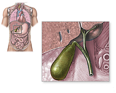 Gall Bladder Disease India, Gall Stones Symptoms India, Gall India, Bladder India, Diet India, Gallbladder India