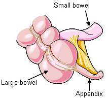 How Much Does Appendix Surgery Cost In India