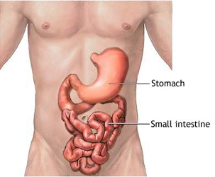 Cost Small Intestine Hospital India, Mal Absorption Syndrome Small Intestine Treatment India