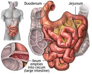 Diseases of the Small Intestine offers info on Diseases of the Small Intestine Treatment India, Mal Absorption Syndrome Small Intestine Treatment   India