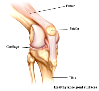 High Flex TKR, High Flexion, High Flex Knee Replacement Surgery India