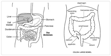 What is a colectomy surgery?