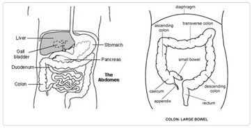 Complications Post Sigmoid Colectomy