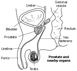 Bladder Outlet Incision Surgery India Offers info on Bladder Outlet Incision Surgeons India, Best Bladder Outlet Incision Surgeon India