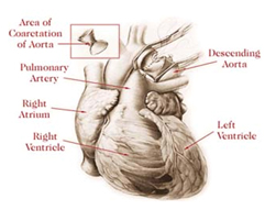 Neonatal Surgery offers info on Neonatal Surgery India, Neonatal India, India Neonatal Surgery Hospitals India, Neonatal Diagnosis India