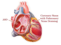 Neonatal Surgery offers info on Neonatal Surgery India, Neonatal India, Neonatal Treatments India, Neonatal Diagnosis India, India Hospital Tour India