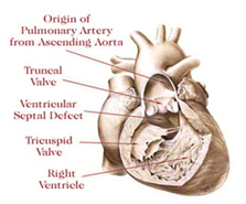 Neonatal Surgery Hospital India, India Neonatal Surgery Hospitals India, Neonatal Treatments India, India Hospital Tour India