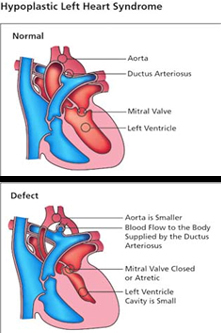 Neonatal Surgery offers info on Neonatal Surgery India, Neonatal India, Neonatal Surgery Hospital India, Neonatal Treatments India, India Hospital Tour India