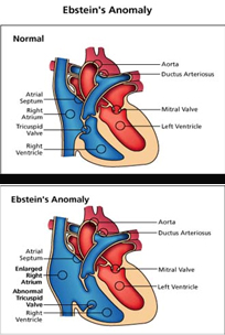 Neonatal Treatments India, Neonatal Diagnosis India, India Hospital Tour India