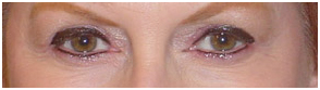 Permanent Makeup India, Cost Permanent Makeup Hospital India, Low Cost Permanent Makeup Treatment Delhi India