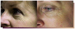 skin Polishing Treatment India, Skin offers info on Skin Problems India, Skin Polish India, Skin Improvement India