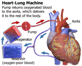 What is the life expectancy of patients who have had heart transplants?